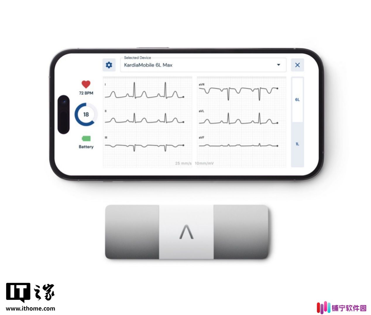 AliveCor 发布 KardiaMobile 6L Max 便携式心电图仪：六导联 ECG 监测，机身小巧能连手机